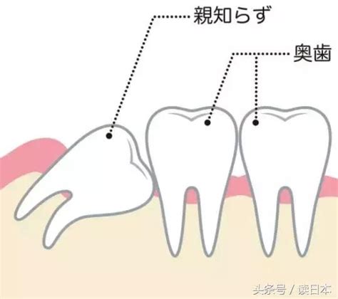 八重齒 意思|為什麼日本人的牙齒普遍不齊？